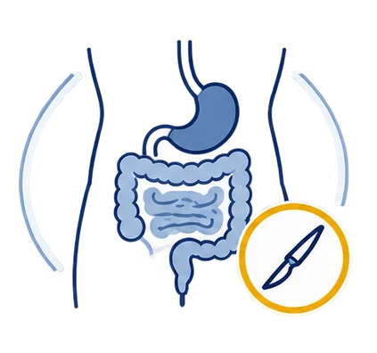 Experiencia en cirugía digestiva y abdominal